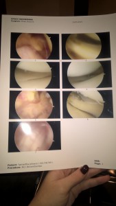 MRI images of Johnson’s knee. | submitted photo by Sam Johnson
